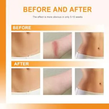 Carbou Silicone Scar Sheets (1.6"x 60"Roll) Medical Silicone Scar Tape Roll,Easy-Tear Soft Silicone Tape for Scars Removal,Reusable Painless Silicone Sheets for Surgery Scars, C-Section, Burn, Keloid