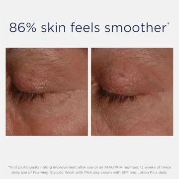 NEOSTRATA Foaming Glycolic Face Wash for All Skin Types