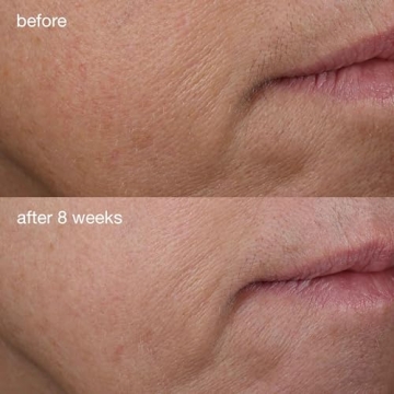 Dermalogica Phyto-Nature Firming Serum - Anti-Aging Powerhouse