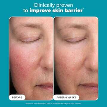 Paula’s Choice 6% Mandelic Acid + 2% Lactic Acid Exfoliant, Gentle Daily AHA Exfoliation for Discoloration, Bumpy Texture & Radiance, for Sensitive Skin, Fragrance-Free & Paraben-Free, 1 Fl. Oz.