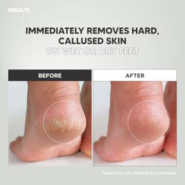 F3 Systems, Wide Emery, Double-Sided Pedicure Tool, Colossal foot file for Men & Women, Effective for Cracked Heel, Callus Remover, Foot Scrubber, Professional , (Pink)