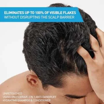 CeraVe Dandruff Shampoo & Conditioner, 1% Zinc Pyrithione Solution