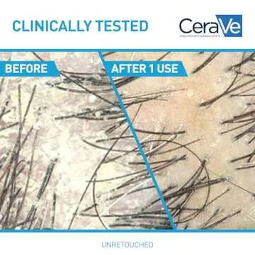 CeraVe Dandruff Shampoo & Conditioner, 1% Zinc Pyrithione Solution