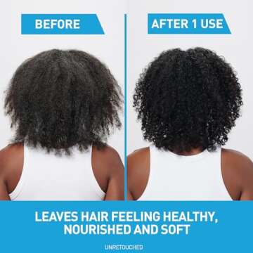 CeraVe Dandruff Shampoo & Conditioner, 1% Zinc Pyrithione Solution