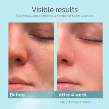 Colorfarm Facial Steamer Nano Ionic: Face Steamer Humidifier Hot Mist Home Sauna Spa - Deep Cleaning Unclogs Pores for Women Men Sinuses Moisturizing