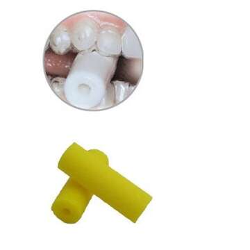 JES Orthodontics Yellow Chewies for Aligner Trays, (10 Chewies per Bag)