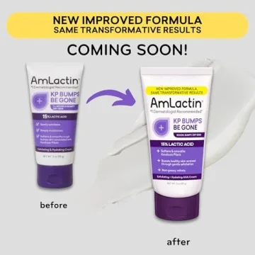 AmLactin KP Bumps Be Gone Cream for Silky Smooth Skin
