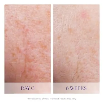 iS CLINICAL Active Serum Anti-Aging Blemish Treatment