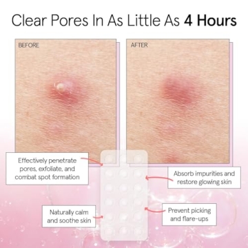 Grace & Stella Acne Patches - Hydrating & Vegan