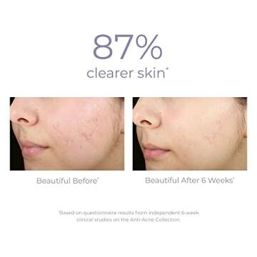 Derma E Sulfur Spot Treatment for Acne-Prone Skin