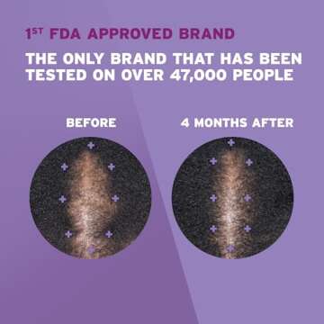 Rogaine 5% Minoxidil Foam, Topical Once-A-Day Hair Loss Treatment for Women to Regrow Fuller, Thicker Hair, Unscented, 2-Month Supply, 2.11 oz