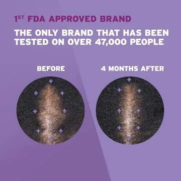 Rogaine 5% Minoxidil Foam, Topical Once-A-Day Hair Loss Treatment for Women to Regrow Fuller, Thicker Hair, Unscented, 2-Month Supply, 2.11 oz