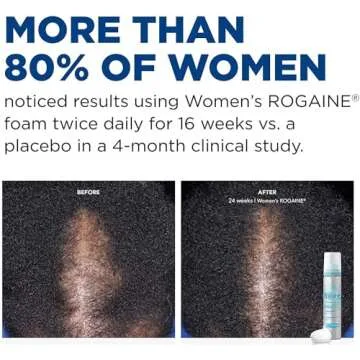 Rogaine 5% Minoxidil Foam, Topical Once-A-Day Hair Loss Treatment for Women to Regrow Fuller, Thicker Hair, Unscented, 2-Month Supply, 2.11 oz