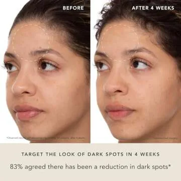 RANAVAT Brightening Saffron Face Serum - Discoloration Correcting Serum & Vitamin C Serum Alternative - Improves Appearance of Hyperpigmentation & Dark Spots (1 oz)