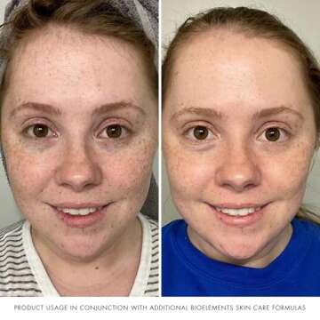 Bioelements Plump Start - 2 fl oz - Skin Plumping Serum to Improve Fullness & Smooth Fine Lines - Includes Collagen-4 Complex - All Skin Types - Vegan, Gluten Free - Never Tested on Animals