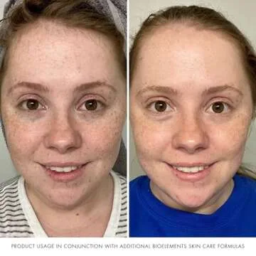 Bioelements Plump Start - 2 fl oz - Skin Plumping Serum to Improve Fullness & Smooth Fine Lines - Includes Collagen-4 Complex - All Skin Types - Vegan, Gluten Free - Never Tested on Animals