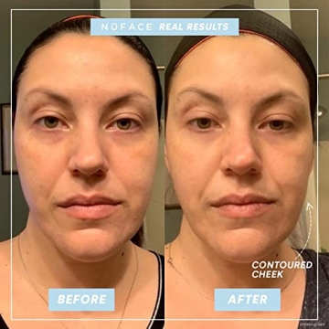 NuFACE Trinity Facial Toning Kit for Youthful Skin