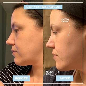 NuFACE Trinity Facial Toning Kit for Youthful Skin