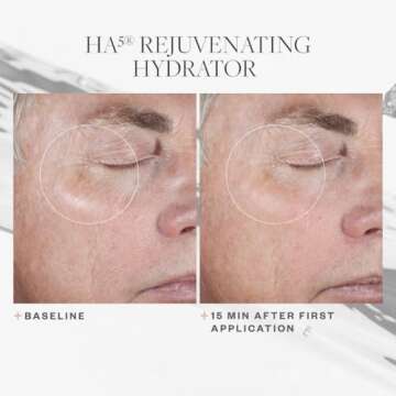 SkinMedica HA5 Rejuvenating Hydrator Hyaluronic Acid Serum for Face with Five Types of Hyaluronic Acid that Smooth Fine Lines and Wrinkles, For All Skin Types, 2 Oz