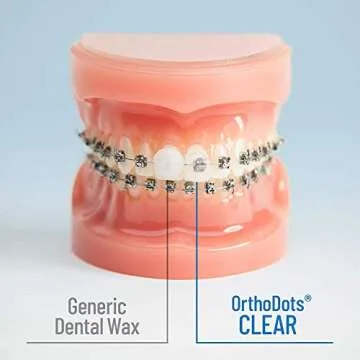 OrthoDots CLEAR – Moisture Activated Braces Wax Alternative for Pain Caused by Braces, Clear Aligner Trays, and Other Orthodontic Appliances. OrthoDots Stick Better and Stay on Longer than Dental Wax.