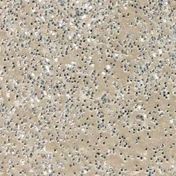 Wow Embossing Powder 15ml-Metallic Platinum Sparkle