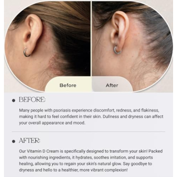 Solaana MD Vitamin D Nourishing Face Cream - Non-Greasy