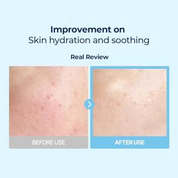 Torriden DIVE IN Multi Pad (80 pads) | Serum infused Facial Pads for Cooling, Soothing, Hydrating Spot Masking | Hyaluronic Acid, Panthenol, Allantoin