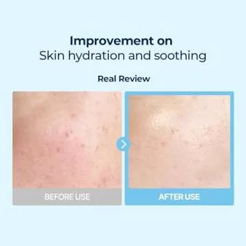 Torriden DIVE IN Multi Pad (80 pads) | Serum infused Facial Pads for Cooling, Soothing, Hydrating Spot Masking | Hyaluronic Acid, Panthenol, Allantoin