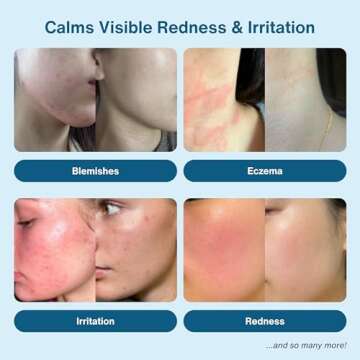 Honeydew Labs Hypochlorous Acid Spray – Eyelid Cleanser, HOCl Face & Skin Mist for Acne, Eczema & Irritation – Multi-Purpose Skin Repair – Post-Workout, Scalp & Sensitive Skin, Travel Size - 2 oz