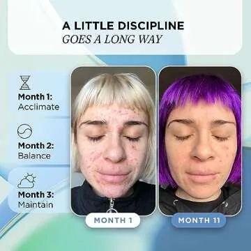 ZitSticka Vitamin Acne Supplement for Cystic Acne w/ 30 Natural Caps for Women and Men, Supplements for Hormonal Support, Skin Clarity, Dark Spots - Dermatologist Tested (Skin Discipline)