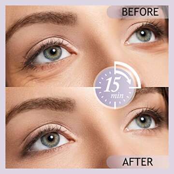 SHVYOG Under Eye Patches for Dark Circles & Puffiness