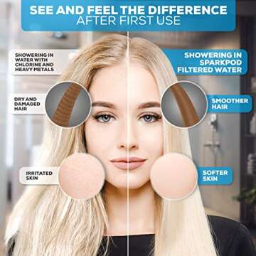 SparkPod High Output Shower Filter for Soft Skin and Hair