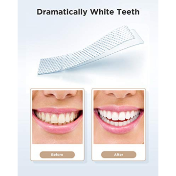 Gloridea Teeth Whitening Strips for a Dazzling Smile