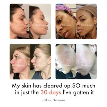 Filterbaby Skincare Filter 2.0, Bathroom Sink Filter Water Faucet for Skin Care, Clinically Tested Starter Kit, Filter w/10 Faucets Adaptors, Sink Water Filter for Skin Protection (Light Pink)