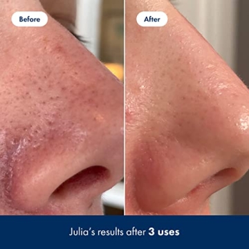 Hero Pore Release Toner for Glowing Clear Skin