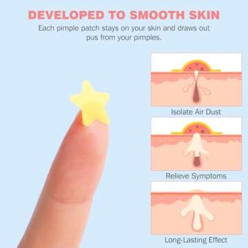 HLOES Pimple Patches for Face 280PCS, Hydrocolloid Acne Patches for Covering Zits and Blemishes, Cut...