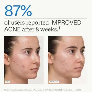 Nutrafol Clear Skin Supplement for Women's Acne Solutions