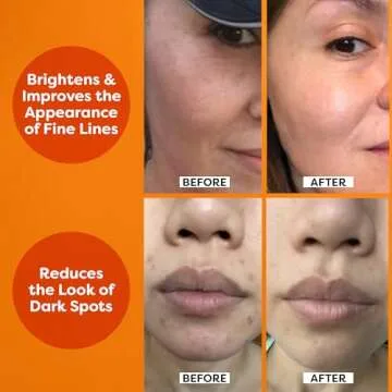 TruSkin Glow and Refresh Duo - Vitamin C Serum 2 fl oz and Hyaluronic Acid Serum 2 fl oz for Glowing, Hydrated Skin