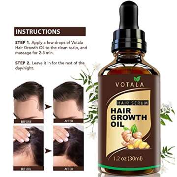 Hair Growth Serum, VOTALA Hair Growth Treatment, Anti Hair Loss, Promotes Thicker, Stronger Hair, And Hair Regrowth for Men Women