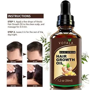 Hair Growth Serum, VOTALA Hair Growth Treatment, Anti Hair Loss, Promotes Thicker, Stronger Hair, And Hair Regrowth for Men Women