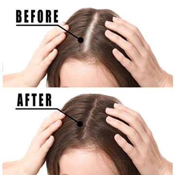 Hair Growth Serum, VOTALA Hair Growth Treatment, Anti Hair Loss, Promotes Thicker, Stronger Hair, And Hair Regrowth for Men Women