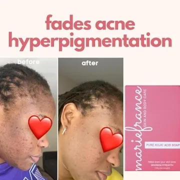 Brighten Skin with Maximum Strength Kojic Acid Soap