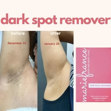 Brighten Skin with Maximum Strength Kojic Acid Soap