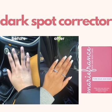 Brighten Skin with Maximum Strength Kojic Acid Soap