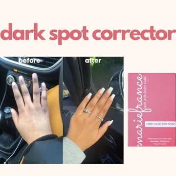 Brighten Skin with Maximum Strength Kojic Acid Soap