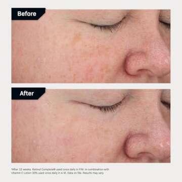 Revision Skincare Retinol Complete® 0.5 Anti Aging Serum