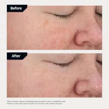 Revision Skincare Retinol Complete® 0.5 Anti Aging Serum