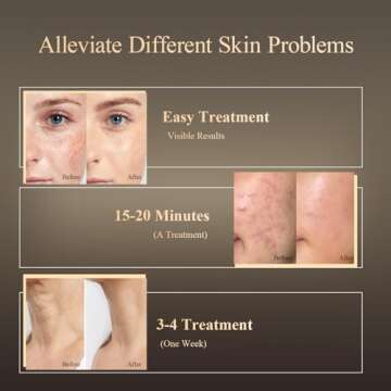 MEGELIN LED Therapy Mask for Face & Neck - 7 Colors Light Therapy