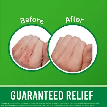 O'Keeffe's Working Hands Cream for Dry Skin Relief