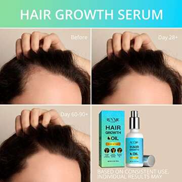 Luv Me Care Hair Growth Serum - All-Natural Oil for Stronger, Thicker, Longer Hair for Women and Men Targeting Hair Loss 1.7 Oz (50 ML)